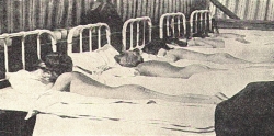 Helioterapia